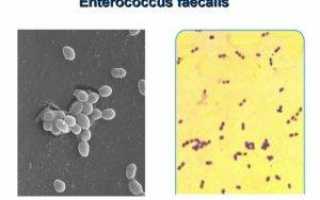 Enterococcus faecalis бактерия