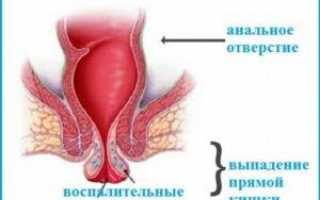 Что вылазит из заднего прохода