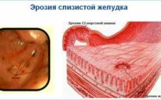 Успокаивающие при гастрите