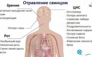 Отравление свинцом