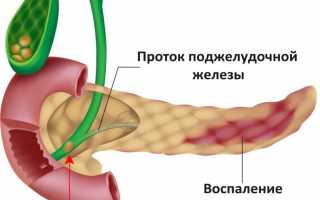 Боль под левым ребром