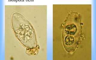 Изоспориаз