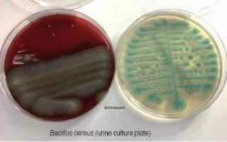 Bacillus cereus toyoi