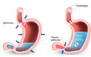 Уменьшился желудок: почему желудок стал меньше