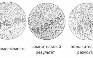 Постокоитальный тест (проба Шуварского): как проводится, расшифровка