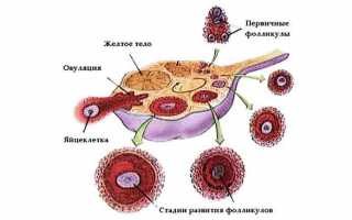 Лютеинизация фолликула: нет овуляции