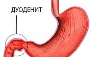 Инфекции желудка симптомы и лечение