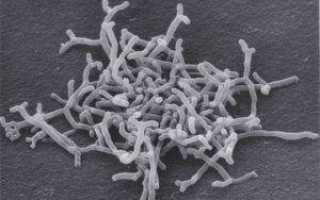 Bifidobacterium longum