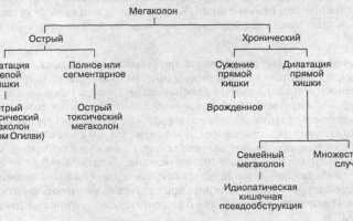 Мегаколон кишечника