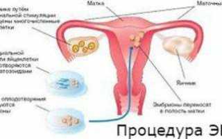 Гиперстимуляция и долгожданная беременность эко