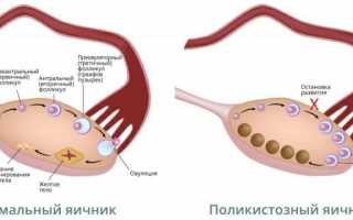 Препараты для стимуляции овуляции список популярных