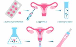 Короткий протокол ЭКО по дням подробно