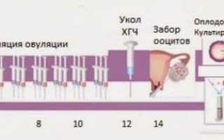 Месячные перед протоколом ЭКО
