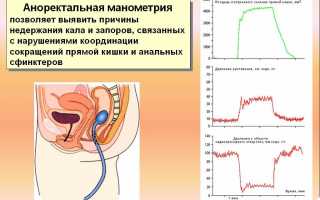 Анальный зуд