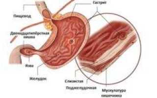 Как лечить аутоиммунный гастрит