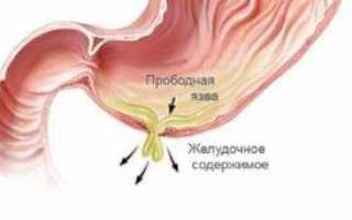 Желудок отдает в спину между лопатками