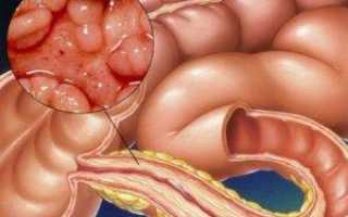 Lactobacillus paracasei бактерии