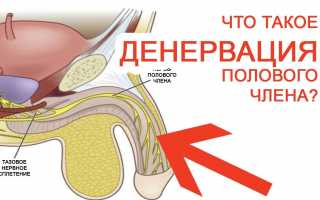 Денервация головки полового члена