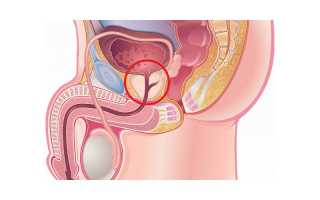 Предстательная железа: размеры, норма у взрослых мужчин