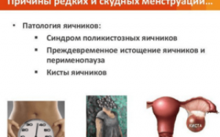 Гипоменорея (скудные месячные): причины, симптомы и лечение