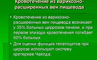 Кровотечение из варикозно расширенных вен пищевода