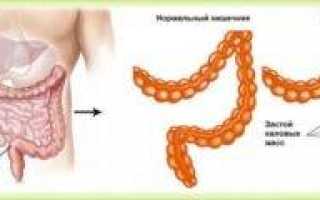 Застой кишечника причины и лечение
